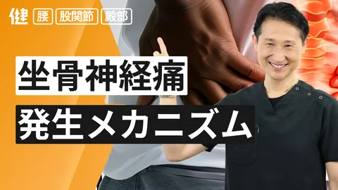 坐骨神経痛のメカニズム